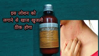 Scarab lotion  lindane and certified lotion  खाज खुलजी के दवा [upl. by Falito]