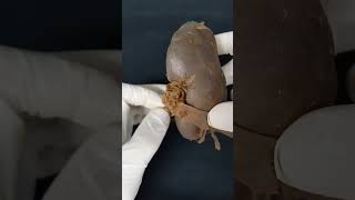 RENAL PARTE 9  Anatomia humana Shorts medicina anatomia aula anatomy biologia [upl. by Sadnac915]