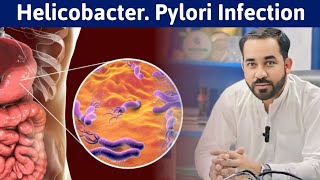 Helicobacter Pylori Treatment with Dr Amjad Ali Shah  Mualij Homeopathic Hospital  H Pylori [upl. by Adikram876]