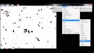 Counting Cells with ImageJ [upl. by Eisenhart]