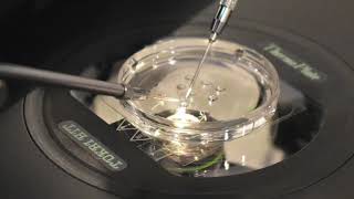 The Process of Intracytoplasmic Sperm Injection for IVF [upl. by Leksehcey]