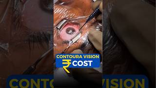 Contoura Vision Cost [upl. by Melak]