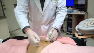 UltrasoundGuided Sacroiliac Joint Injectionwmv [upl. by Edlun]