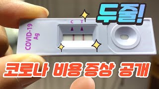 코로나 자가진단 키트 양성 후 신속항원검사 양성 후 확진 I 검사 비용 증상 약 처방 공개 후기 I 자가격리 7일 재택치료 들어가요 [upl. by Dayna]