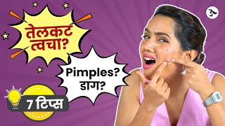 Acne Spot Removal  Oily Skin Moisturizer  Pimples Treatment at Home  Acne Scars Urmila Nimbalkar [upl. by Oslec]