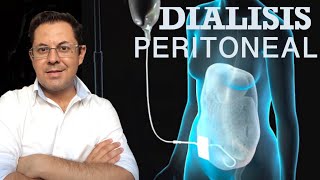 DIALISIS PERITONEAL [upl. by Olson911]