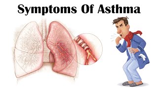 Asthma Symptoms  What Are The Major Symptoms Of Asthma [upl. by Onateag]