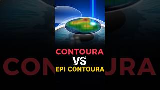 Contoura Vision VS EPI Contoura [upl. by Nitsyrk106]