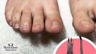 How to Clean Toenails at Home nails toenailcleaning [upl. by Ramoj]