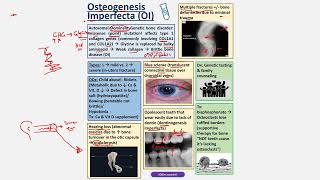 Osteogenesis Imperfecta CBL [upl. by Hcirdeirf728]