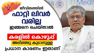 ജീവിതത്തിൽ ഫാറ്റി ലിവർ വരില്ല ഇങ്ങനെ ചെയ്താൽ \ കരളിൽ കൊഴുപ്പ് അടിഞ്ഞു കൂടാനുള്ള പ്രധാന കാരണം ഇതാണ് [upl. by Akitan]