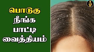 Podugu thollai neenga tips Tamil  பொடுகு நீங்க பாட்டி வைத்தியம்  Podugu povathu eppadi  Dandruff [upl. by Eiboh]