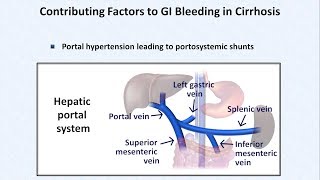 Esophageal Varices and Variceal Hemorrhage [upl. by Chicoine531]