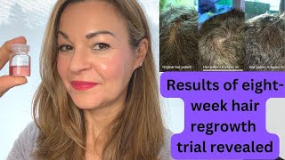 Does this stem cellderived serum regenerate hair growth Calecim 6 and 8 week results revealed [upl. by Enar543]