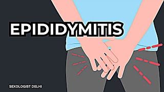 Epididymitis यह नामर्द बना देता है [upl. by Ailedo]