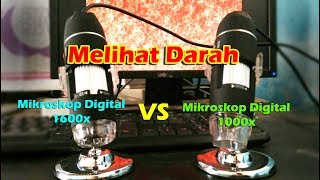 Perbandingan Pembesaran Darah Antara Mikroskop Digital 1000x vs Mikroskop Digital 1600 [upl. by Irab769]