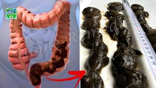 How To Clean Your Stomach and Intestines Naturally in One Day [upl. by Sarita]