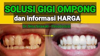 GIGI OMPONG solusi dan perkiraan biaya [upl. by Marlow421]