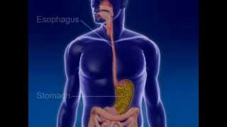 Understanding Gastroesophageal Reflux Disease GERD [upl. by Edelstein736]