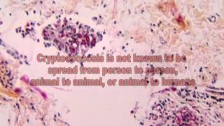 Cryptococcus Fungi The Cause of Cryptococcosis [upl. by Marasco497]