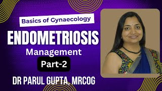 Endometriosis Part  2  Management [upl. by Iroc]