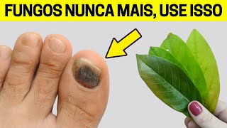 NUNCA MAIS TIVE FUNGOS E MICOSE NAS UNHAS DEPOIS QUE USEI ESSA RECEITA [upl. by Bickart]