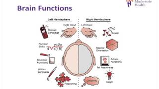 Stroke Education  Causes and Effects [upl. by Emelina]