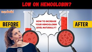 5 Ways to Increase Hemoglobin and Iron levels Naturally How to increase hemoglobin naturally [upl. by Ecyle]