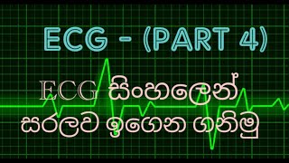 ECG in Sinhala  Part 4  lesson 33 QRS Complex in limb leads  e  collection [upl. by Vincenty]