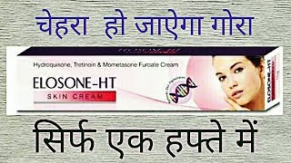 Elosone HT Cream Review Side Effects UsesBest Fairness Cream For Marks [upl. by Gone]