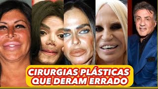 CIRURGIAS PLÁSTICAS QUE NÃO DERAM CERTOcirurgiaplastica bizarras famosos [upl. by Liza983]