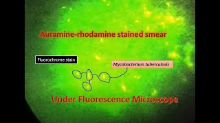 Auramine phenol stain Mycobacterium positveFluorescence microscope [upl. by Atnuahc]