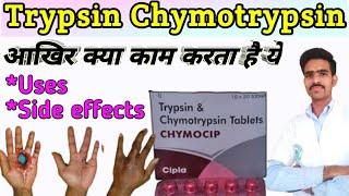 trypsin chymotrypsin tablet uses in hindi  trypsin bromelain rutoside trihydrate tablets  Trypsin [upl. by Nance]