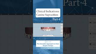 Clinical Indications Canine Suprasition Part 4 [upl. by Sirk449]