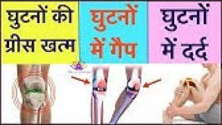 Diacerein Glucosamine Sulphate MSM Tablet review in hindi [upl. by Lihka]