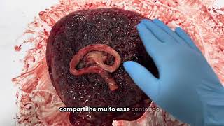 😱PLACENTA E O CORDÃO UMBILICAL  Órgão incrível da formação da vida [upl. by Nevur]