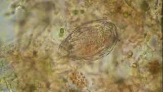 Rotifer under the microscope [upl. by Baruch845]