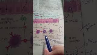 Pathogenesis of Celiac Disease  Robbin  Pathology [upl. by Lynda]