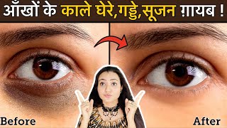 In 7 Days 💕 Remove DARK CIRCLES काले घेरे PUFFY EYES गड्ढे SUNKEN EYES Naturally  100 Results [upl. by Freddy922]