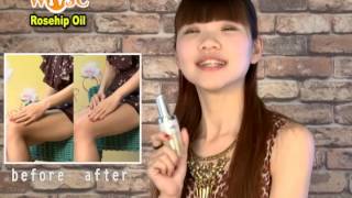 Rosehip Seed Oil Scar Remover [upl. by Coleen]