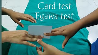 Card testEgawa testulnar nerve palsyclaw hand [upl. by Atinit]