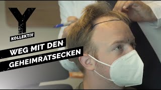 Haartransplantation in der Türkei  Schönheitsoperationen bei Männern  YKollektiv [upl. by Nivrae692]