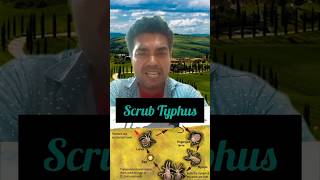 Scrub typhus se kese bache  Scrub typhus kya hai shorts shortsfeed scrubtyphus health [upl. by Clarita]