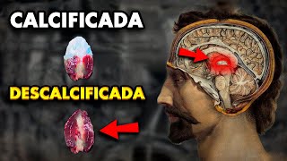 👁️ ASÍ LOGRÉ DESCALCIFICAR MI GLÁNDULA PINEAL  Tercer Ojo [upl. by Roux]