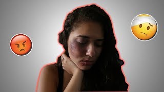 I GOT BEAT UP PRANK ON BOYFRIEND  CRAZY [upl. by Attiuqehs]