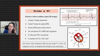 Como interpretar um eletrocardiograma ritmo e frequência cardíaca [upl. by Arayk]