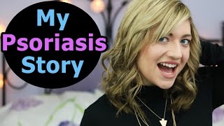 MY PSORIASIS STORY  Psoriasis Treatment Psoriasis Diet Positive Affirmations  Guttate Psoriasis [upl. by Yelsha]