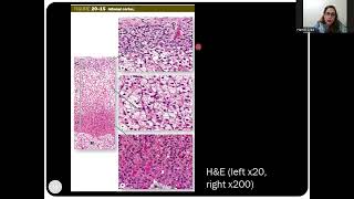 Histology of the Adrenal Suprarenal Glands [upl. by Kovar]