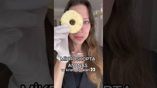 MİKROSKOPTA ANANAS 🍍 YERKEN NEDEN DİLİMİZ GIDIKLANIYOR 👀 [upl. by Gnohp]