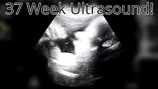 37 Week Ultrasound  How Big Is Baby [upl. by Bremser]